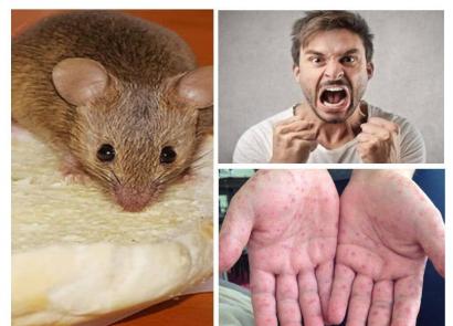 Симптомы мышиной лихорадки у взрослых мужчин